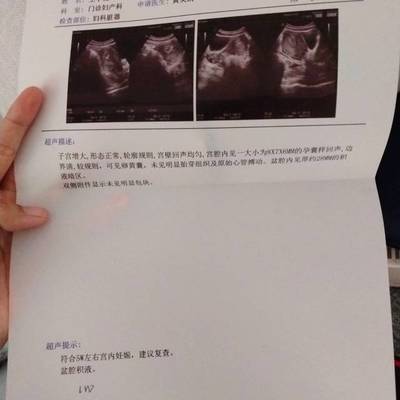 怀孕21天能看到孕囊吗