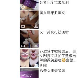 祛斑针需要注意什么