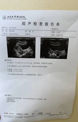 去医院查怀孕要多久