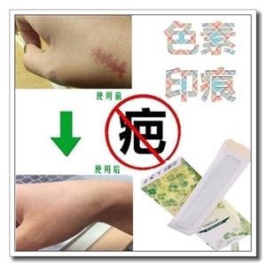 痘痘贴粘多久