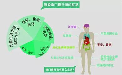 螺杆菌怎么治疗