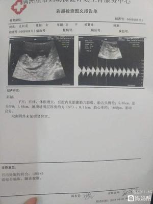 怀孕12周胎儿会动吗