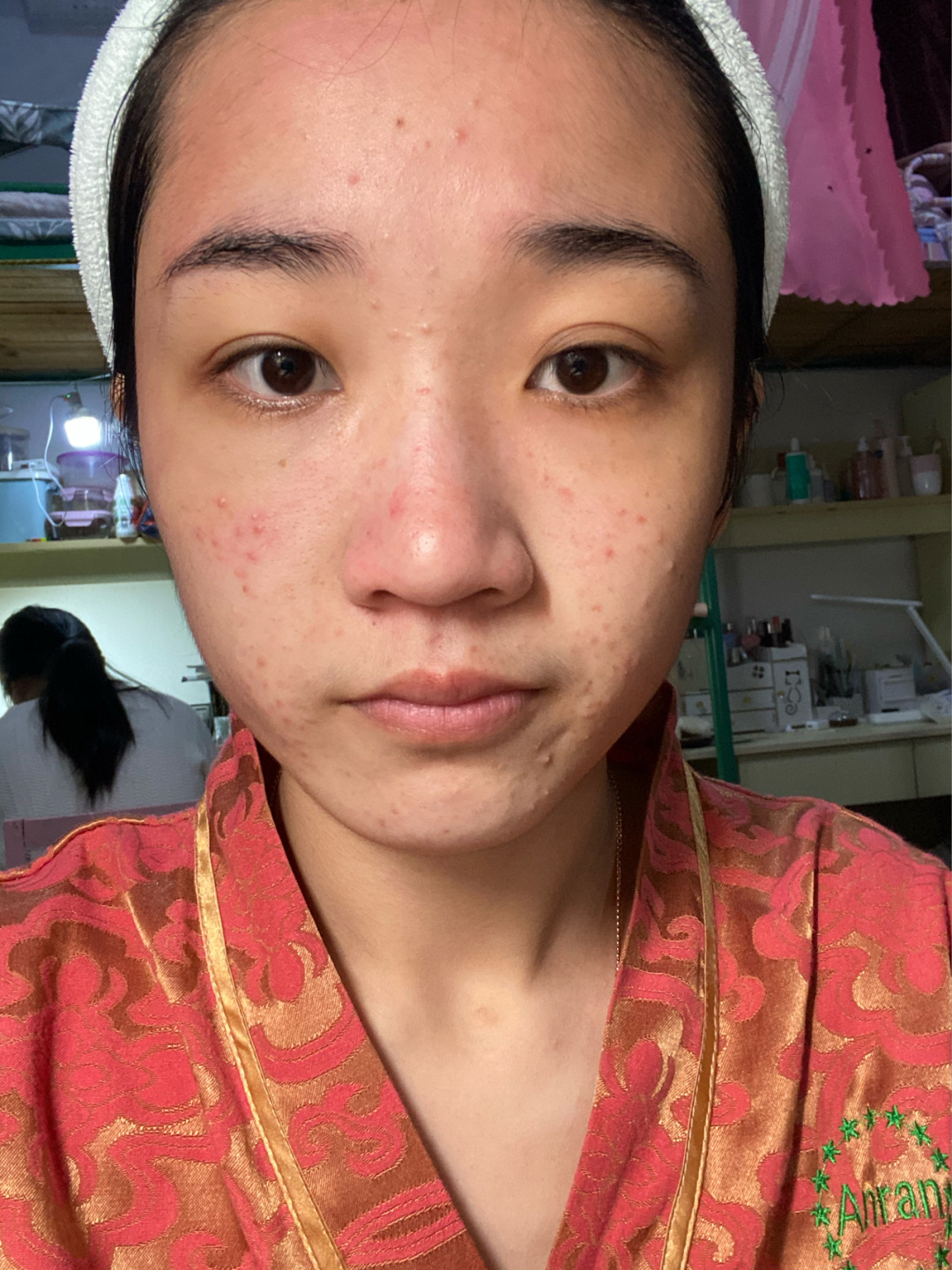 脸上有痘痘适合什么精华