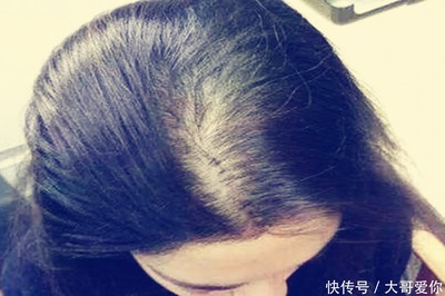 做头发后多久可以怀孕