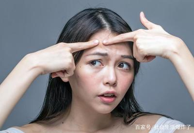 额头喜欢长痘痘