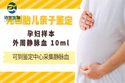 胎儿可以做亲子鉴定么