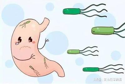 螺杆菌怎么治疗