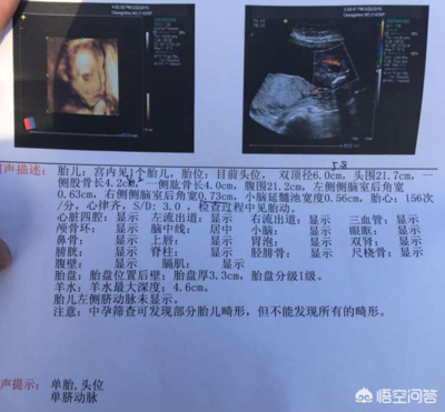 怀孕6个多月胎动少正常吗
