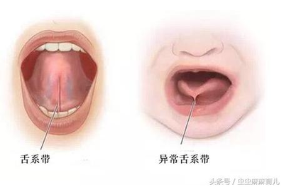 宝宝舌头底下正常图片