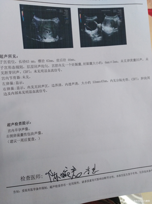 怀孕卵巢囊肿怎么办