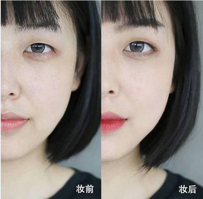 痘痘坑可以用遮瑕膏住吗