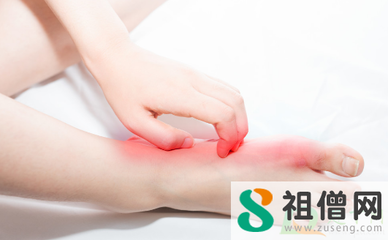 痛风怎么治疗最有效