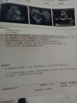 30周胎儿图片