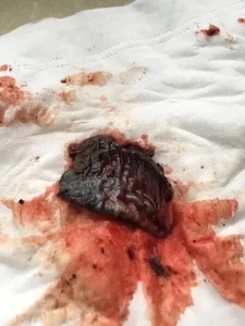 月经黑是怎么回事