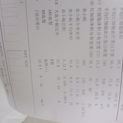 胎儿sd值偏高怎么回事