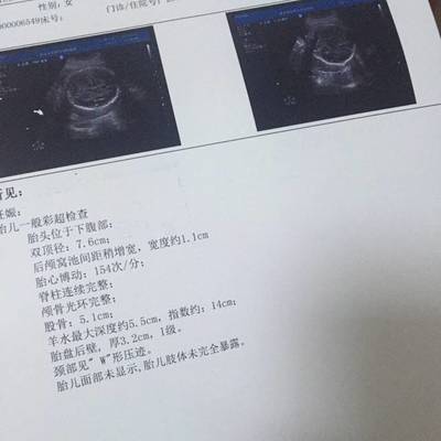 胎儿七个月双顶径标准