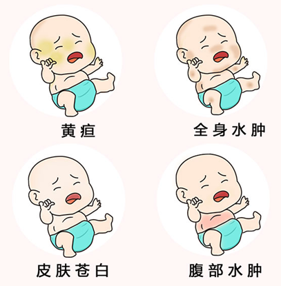 孕妇地贫对胎儿有什么影响