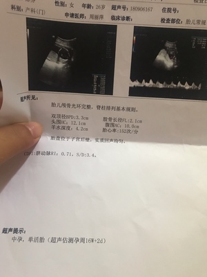 胎儿四个月有多大