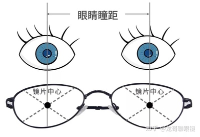 三棱镜100度是多少斜视