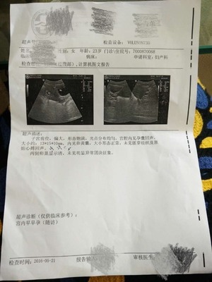 孕妇胎儿心跳多少正常