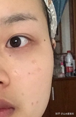 没洗脸敷面膜会怎么样