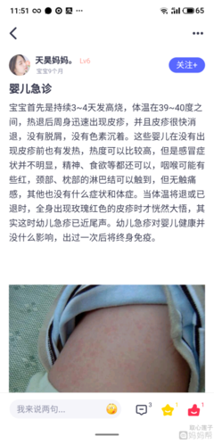 九个月宝宝的正常体温是多少
