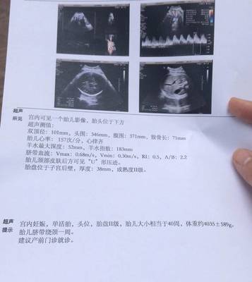 怀孕38周胎儿双顶径多少正常