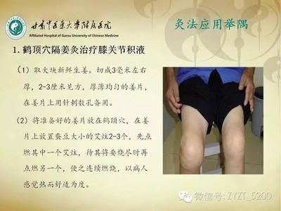 膝盖积液中医怎么治疗