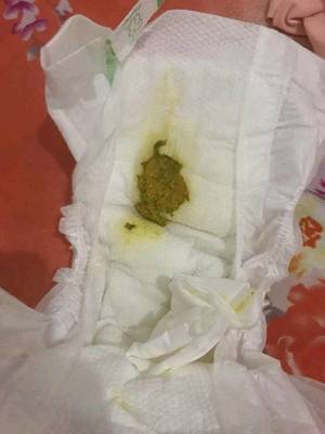 一个月的宝宝老是放屁怎么回事
