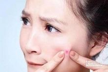 脸上起痘痘饮食