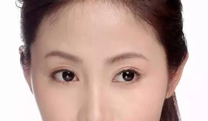双眼皮什么时候做最好
