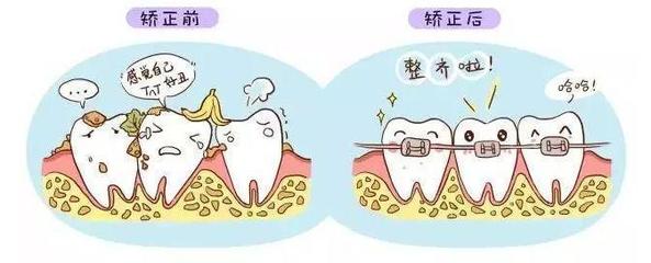 牙齿矫正好处