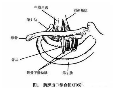 肋骨抽筋疼是怎么回事