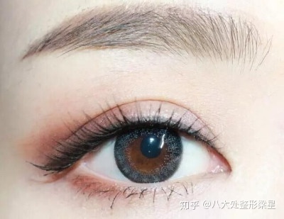经期做双眼皮