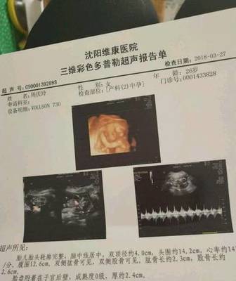 十七周的胎儿彩超图