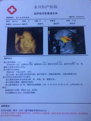 33周宝宝4斤正常吗