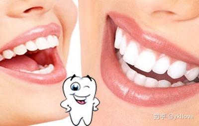 补牙齿怎么补