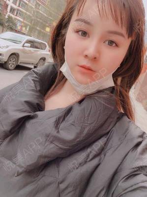 脂肪填充后下巴长痘痘