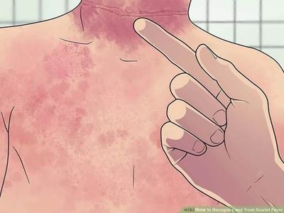 脖子充血是怎么回事