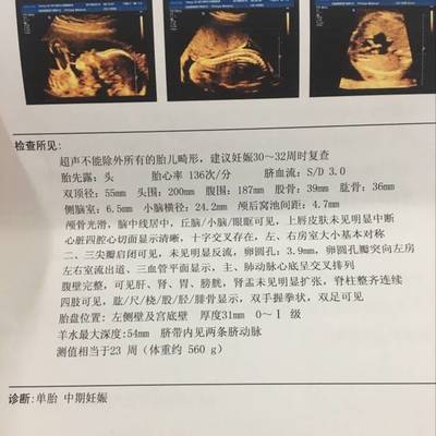 32周胎宝宝
