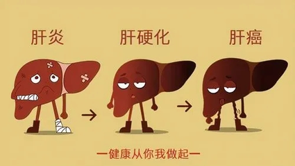 肝炎怎么治疗最好的方法