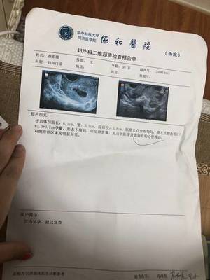 检查是否怀孕挂什么科