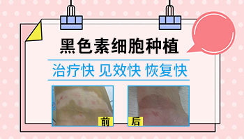 腋下有白斑是怎么回事