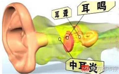 耳朵脓肿怎么治疗方法