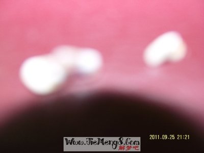 做梦梦到坏牙齿掉了是什么意思