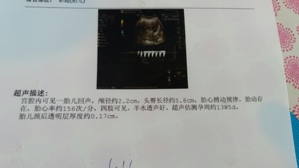 胎儿蜷缩成一团彩超图