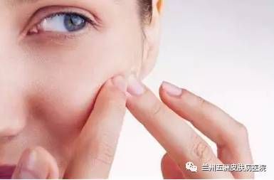 挤出白头的痘痘