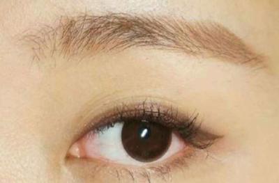 单眼皮有卧蚕吗