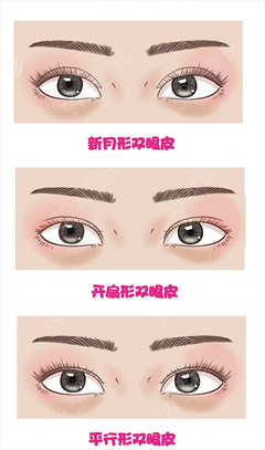 双眼皮的坏处