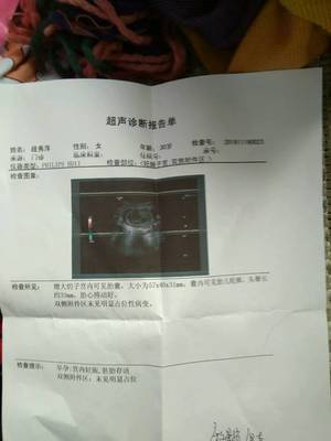 怎么算怀孕几周